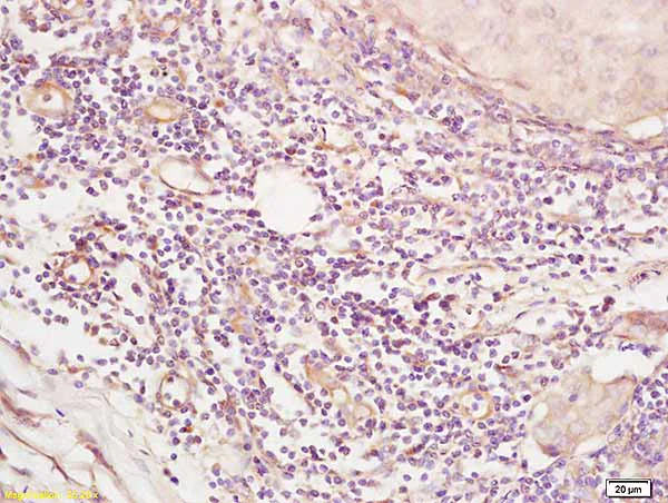 Immunohistochemistry (Formalin/PFA-fixed paraffin-embedded sections) - Anti-SGK3 antibody (AB218251)