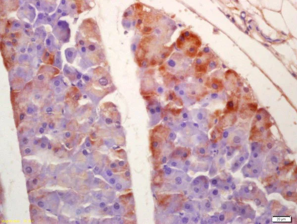 Immunohistochemistry (Formalin/PFA-fixed paraffin-embedded sections) - Anti-SGK3 antibody (AB218251)