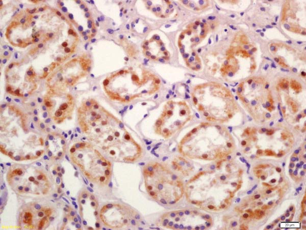 Immunohistochemistry (Formalin/PFA-fixed paraffin-embedded sections) - Anti-SGK3 antibody (AB218251)