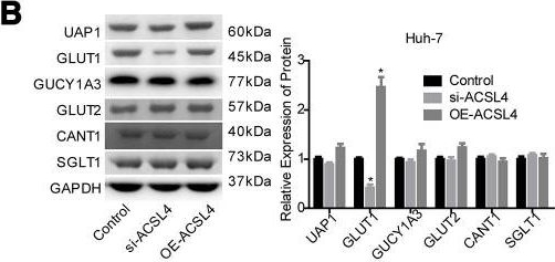 Western blot - Anti-SGLT1 antibody (AB14686), expandable thumbnail
