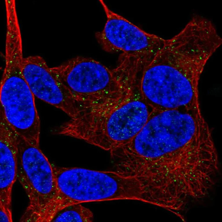 Immunocytochemistry/ Immunofluorescence - Anti-SGLT1 antibody (AB247121)