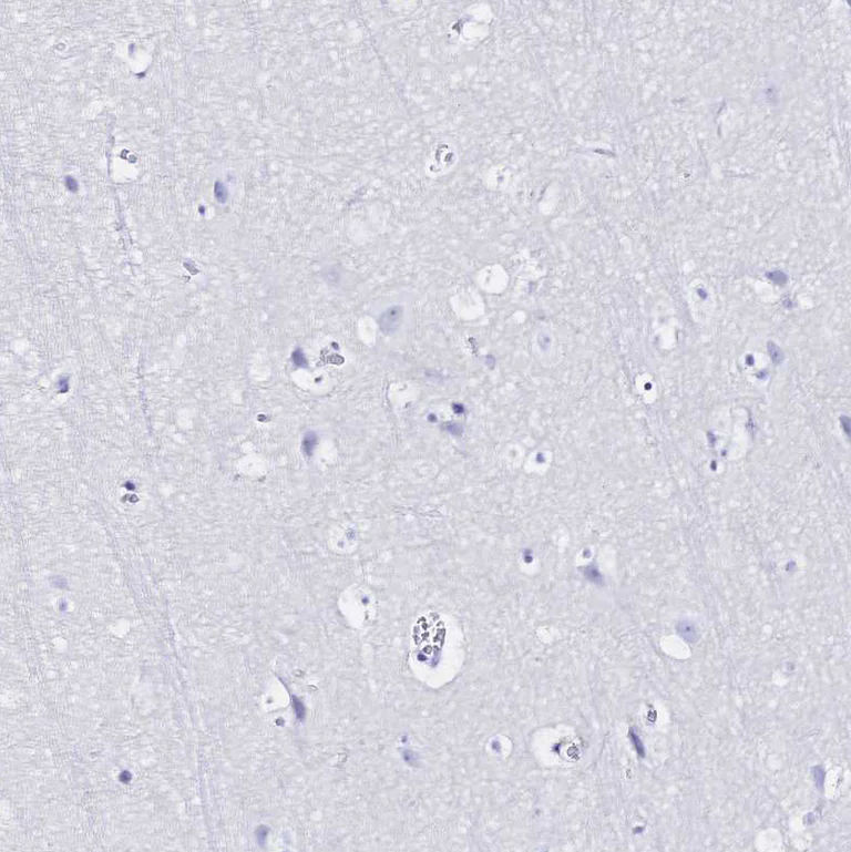 Immunohistochemistry (Formalin/PFA-fixed paraffin-embedded sections) - Anti-SGLT1 antibody (AB247121)