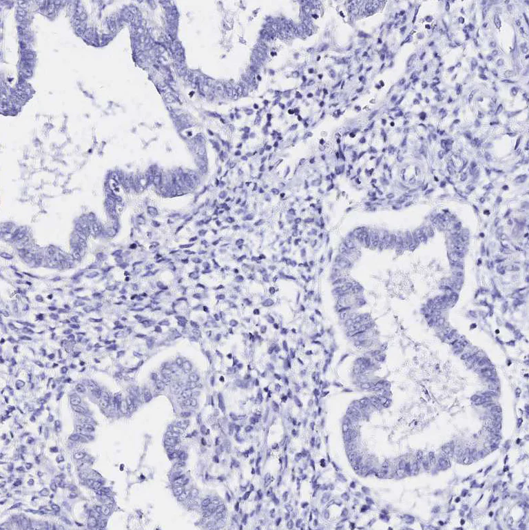 Immunohistochemistry (Formalin/PFA-fixed paraffin-embedded sections) - Anti-SGLT1 antibody (AB247121)
