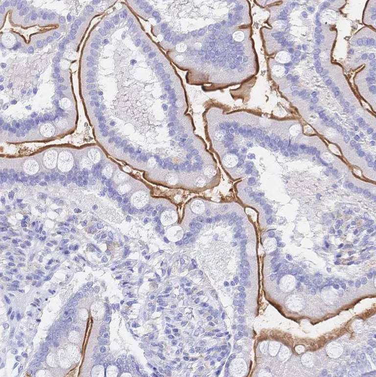 Immunohistochemistry (Formalin/PFA-fixed paraffin-embedded sections) - Anti-SGLT1 antibody (AB247121)