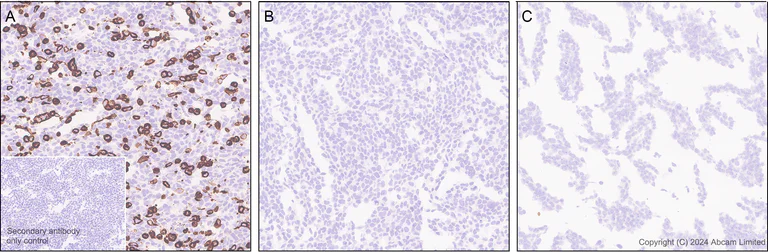 Immunohistochemistry (Formalin/PFA-fixed paraffin-embedded sections) - Anti-SGLT1 antibody [EPR26041-107] (AB321787)