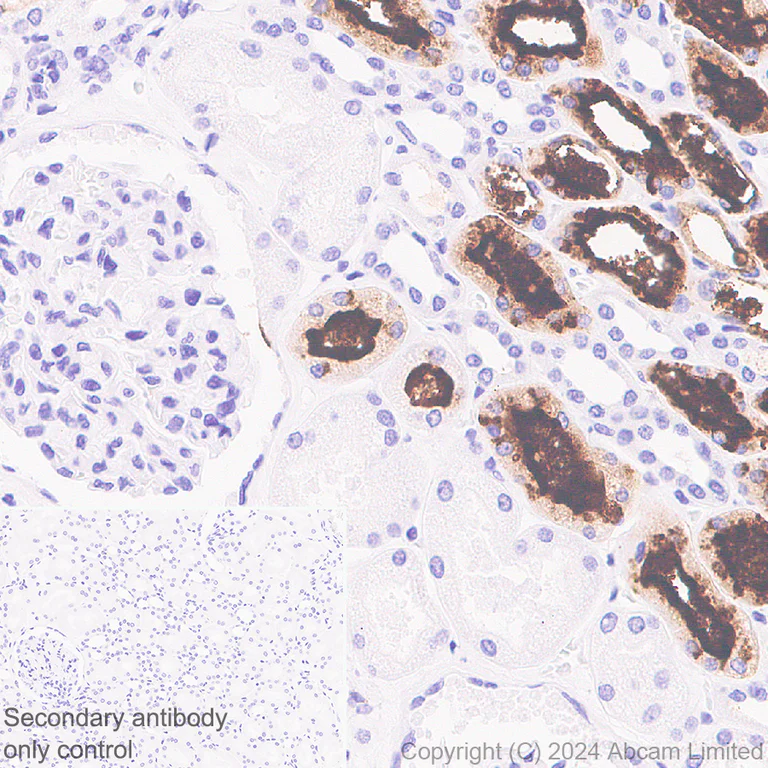 Immunohistochemistry (Formalin/PFA-fixed paraffin-embedded sections) - Anti-SGLT1 antibody [EPR26041-107] (AB321787)