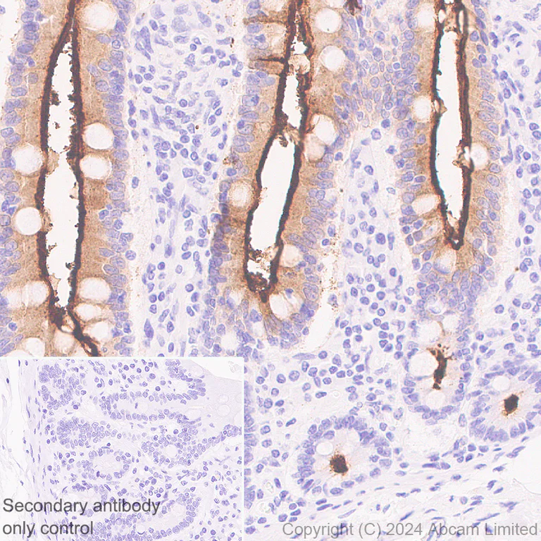 Immunohistochemistry (Formalin/PFA-fixed paraffin-embedded sections) - Anti-SGLT1 antibody [EPR26041-107] (AB321787)