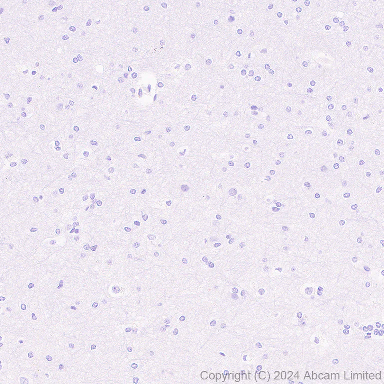 Immunohistochemistry (Formalin/PFA-fixed paraffin-embedded sections) - Anti-SGLT1 antibody [EPR26041-107] - BSA and Azide free (AB321788)