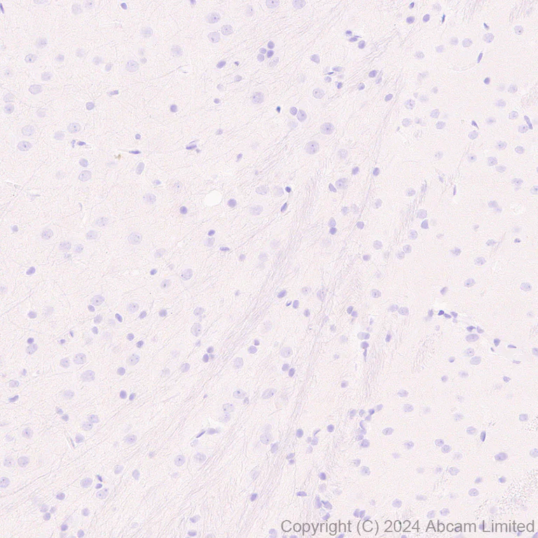 Immunohistochemistry (Formalin/PFA-fixed paraffin-embedded sections) - Anti-SGLT1 antibody [EPR26041-107] - BSA and Azide free (AB321788)