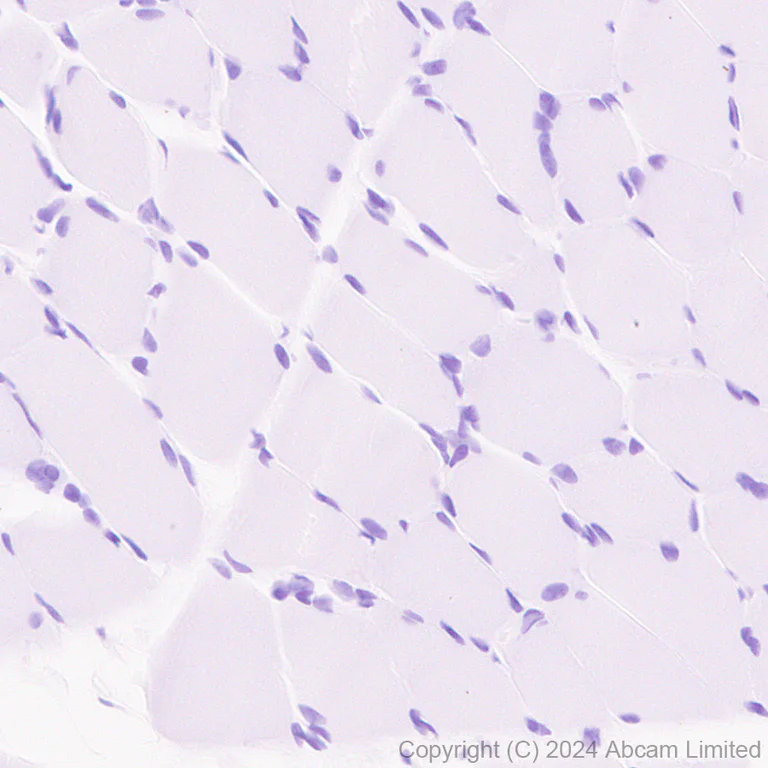 Immunohistochemistry (Formalin/PFA-fixed paraffin-embedded sections) - Anti-SGLT1 antibody [EPR26041-107] - BSA and Azide free (AB321788)