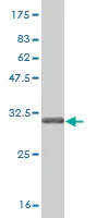 Western blot - Anti-SGLT2 antibody [3G8] (AB58298)