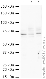Western blot - Anti-SGLT2 antibody (AB37296), expandable thumbnail