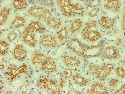 Immunohistochemistry (Formalin/PFA-fixed paraffin-embedded sections) - Anti-SGLT2 antibody (AB85626)