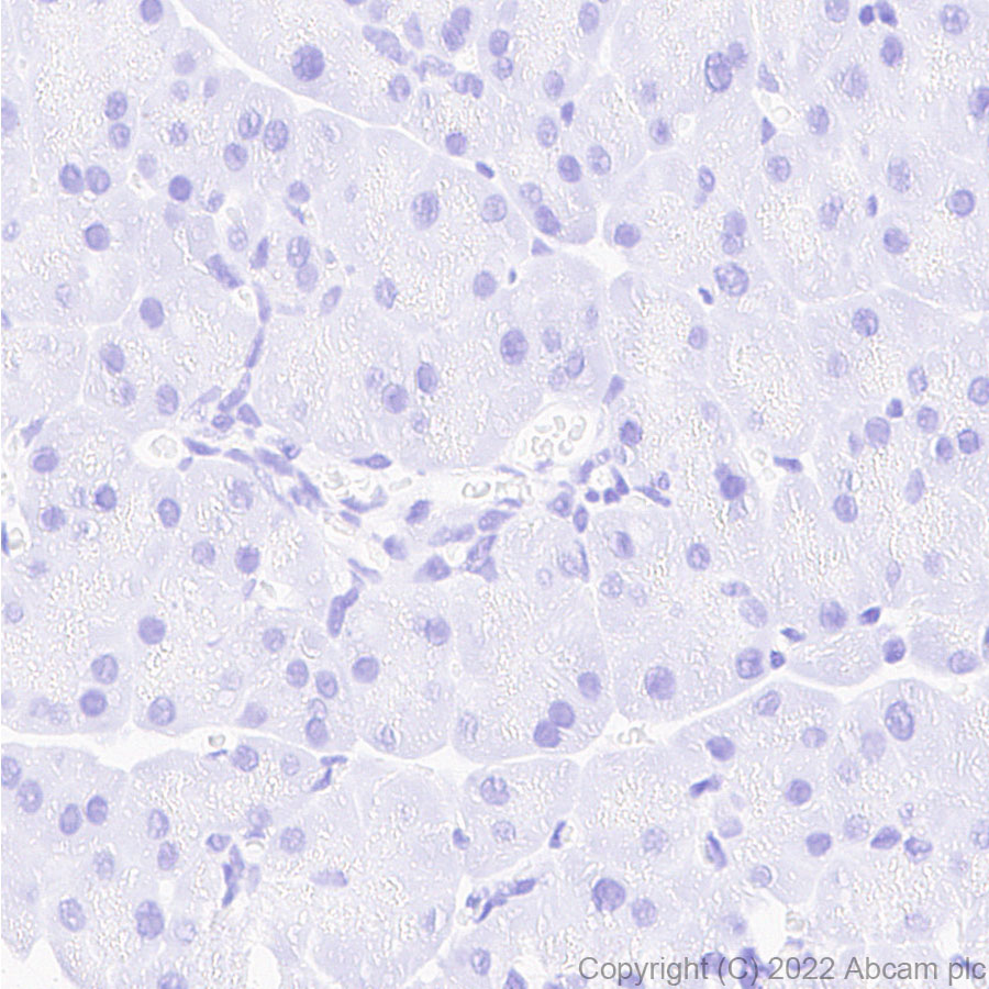 Immunohistochemistry - Anti-SGLT2 antibody [EPR27112-7] (ab306558), expandable thumbnail