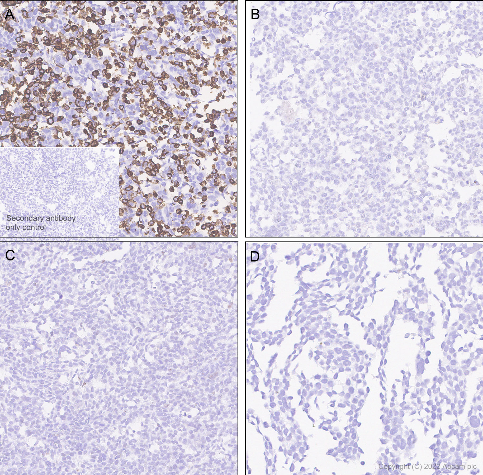 Immunohistochemistry - Anti-SGLT2 antibody [EPR27112-7] (ab306558), expandable thumbnail