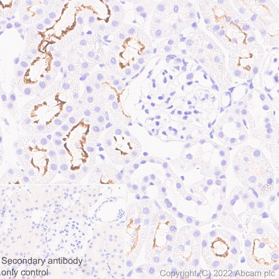 Immunohistochemistry - Anti-SGLT2 antibody [EPR27112-7] (ab306558), expandable thumbnail