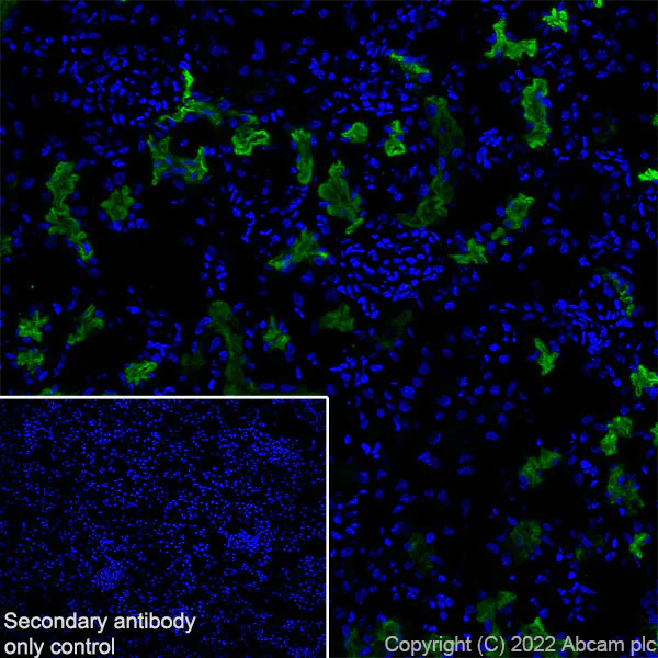 Immunohistochemistry (Frozen sections) - Anti-SGLT2 antibody [EPR27112-7] - BSA and Azide free (AB306559)