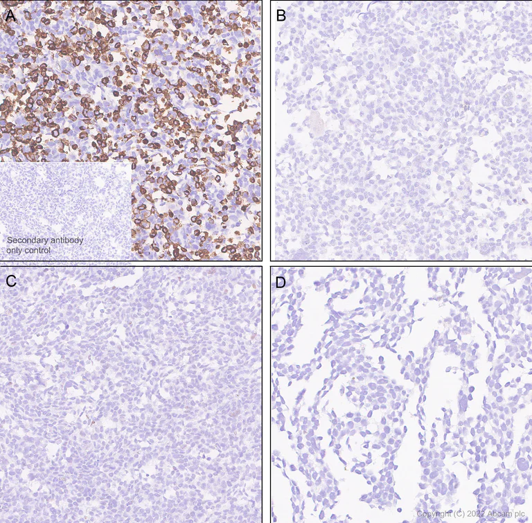 Immunohistochemistry - Anti-SGLT2 antibody [EPR27112-7] - BSA and Azide free (AB306559)