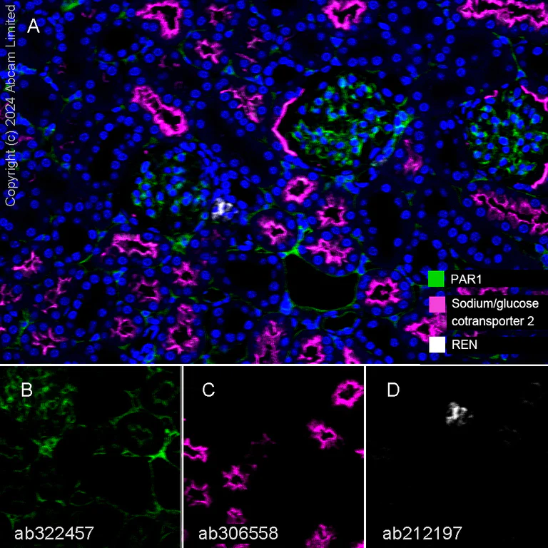 Immunohistochemistry - Anti-SGLT2 antibody [EPR27112-7] - BSA and Azide free (AB306559)