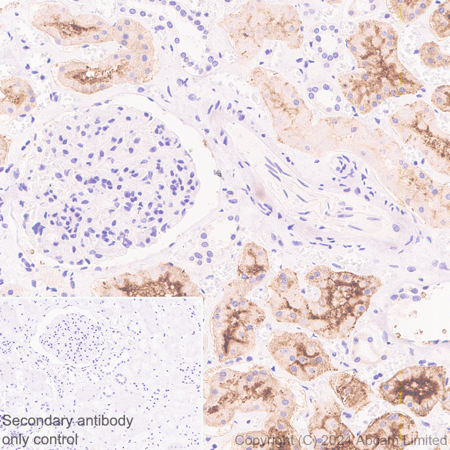 Immunohistochemistry (Formalin/PFA-fixed paraffin-embedded sections) - Anti-SGLT2 antibody [EPR29167-46] (ab320086), expandable thumbnail