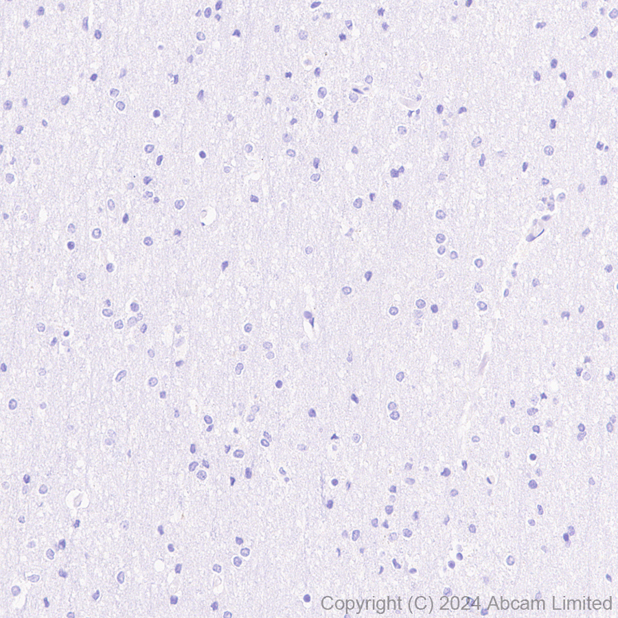Immunohistochemistry (Formalin/PFA-fixed paraffin-embedded sections) - Anti-SGLT2 antibody [EPR29167-46] (AB320086), expandable thumbnail