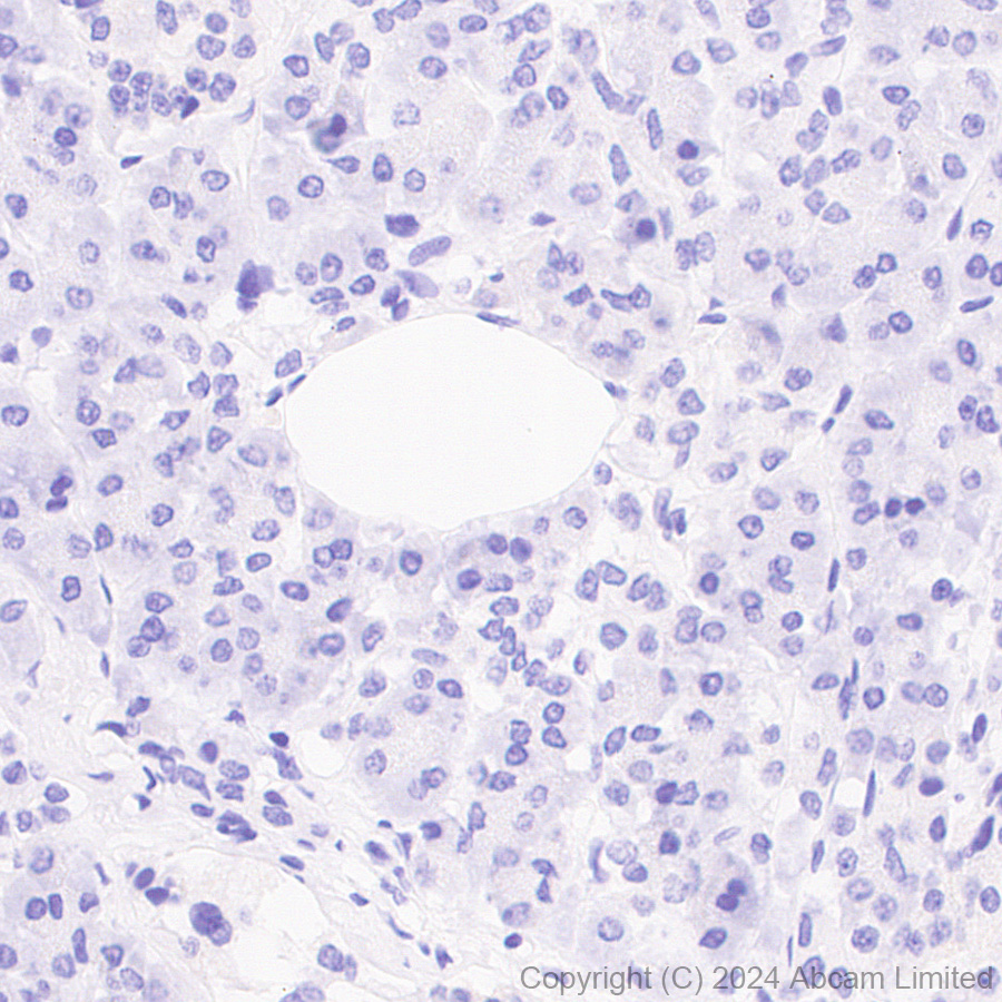 Immunohistochemistry (Formalin/PFA-fixed paraffin-embedded sections) - Anti-SGLT2 antibody [EPR29167-46] (AB320086), expandable thumbnail