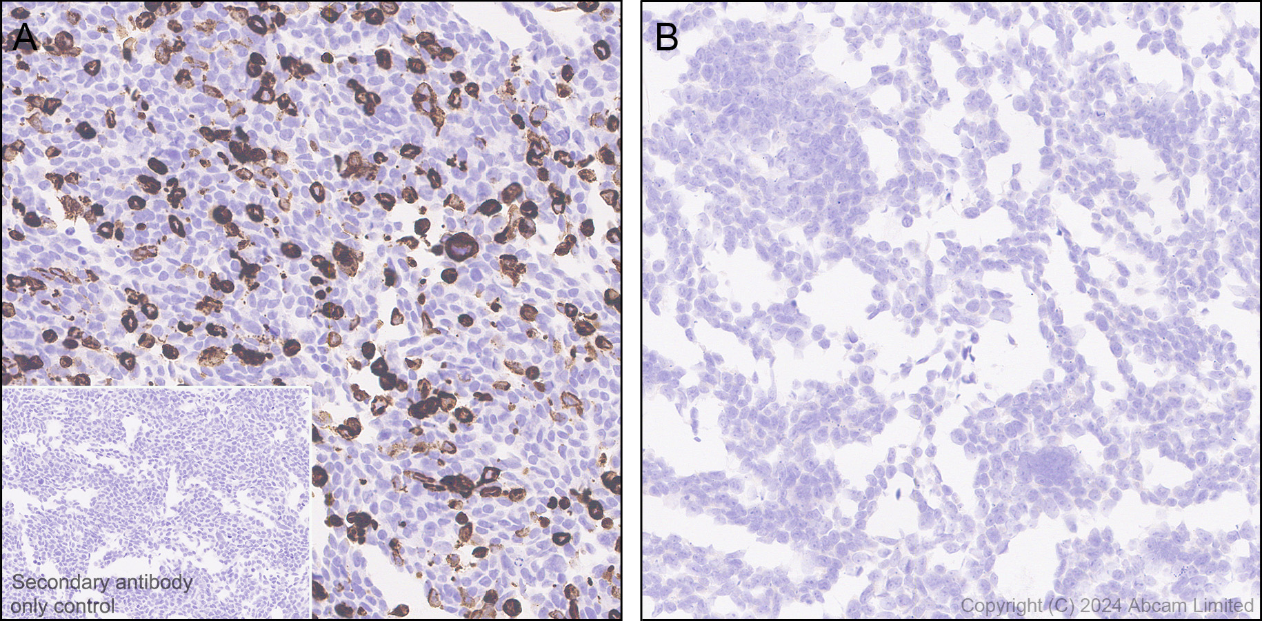 Immunohistochemistry (Formalin/PFA-fixed paraffin-embedded sections) - Anti-SGLT2 antibody [EPR29167-46] (AB320086), expandable thumbnail