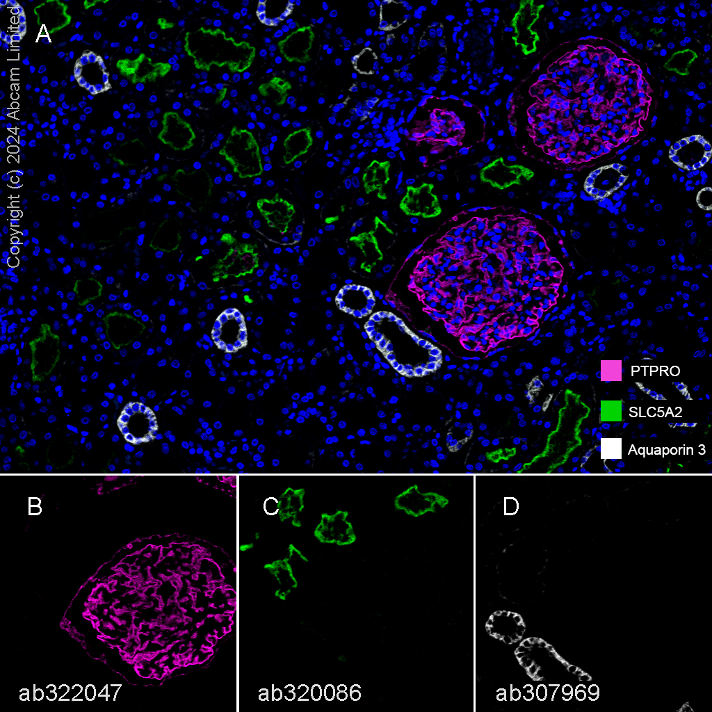 Multiplex immunohistochemistry - Anti-SGLT2 antibody [EPR29167-46] (AB320086), expandable thumbnail