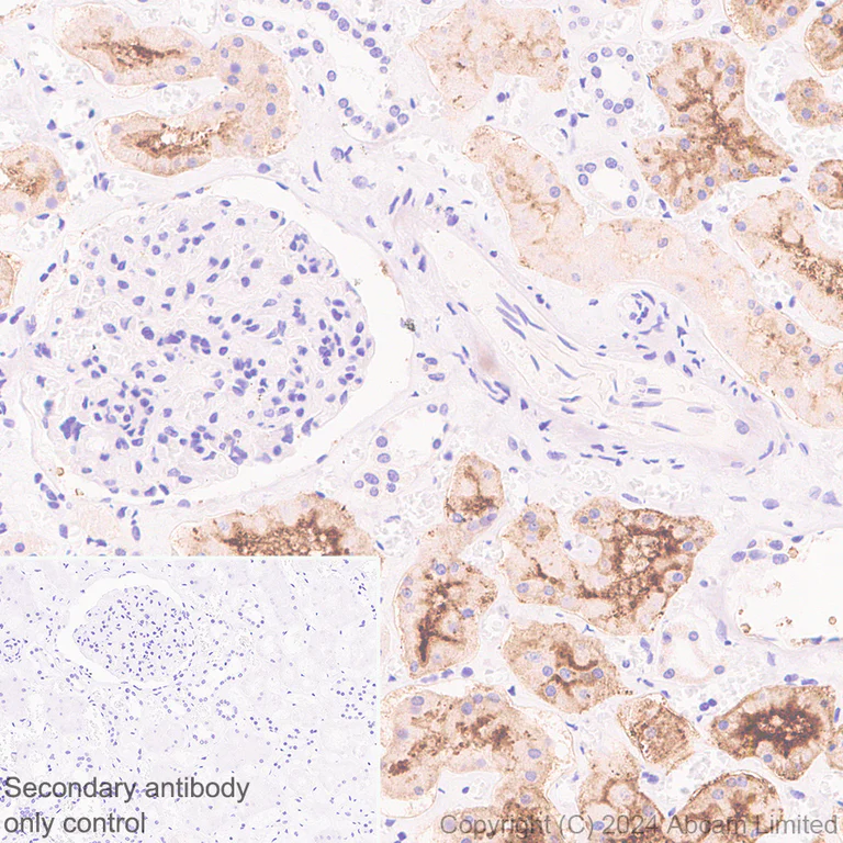 Immunohistochemistry (Formalin/PFA-fixed paraffin-embedded sections) - Anti-SGLT2 antibody [EPR29167-46] - BSA and Azide free (AB320087)