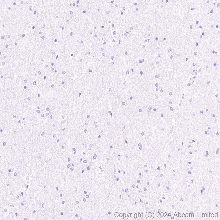 Immunohistochemistry (Formalin/PFA-fixed paraffin-embedded sections) - Anti-SGLT2 antibody [EPR29167-46] - BSA and Azide free (AB320087)