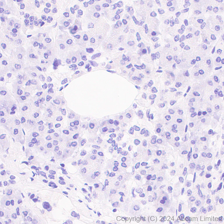 Immunohistochemistry (Formalin/PFA-fixed paraffin-embedded sections) - Anti-SGLT2 antibody [EPR29167-46] - BSA and Azide free (AB320087)