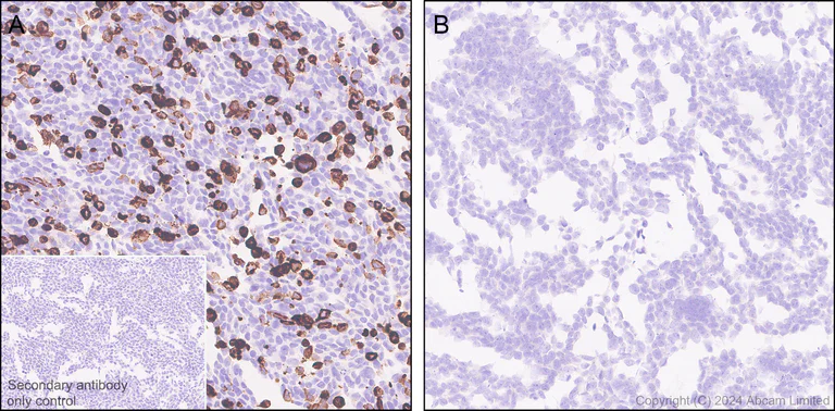 Immunohistochemistry (Formalin/PFA-fixed paraffin-embedded sections) - Anti-SGLT2 antibody [EPR29167-46] - BSA and Azide free (AB320087)