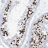 Immunohistochemistry (Formalin/PFA-fixed paraffin-embedded sections) - Anti-SGOL2 antibody (AB122258)
