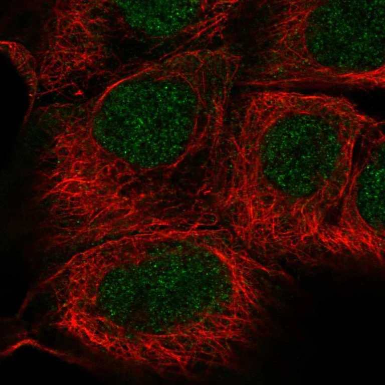 Immunocytochemistry/ Immunofluorescence - Anti-SGPP1 antibody (AB262889)