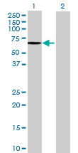 Western blot - Anti-SGSH/HSS antibody (AB72617)
