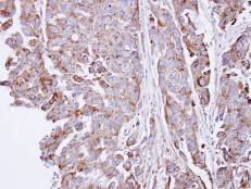 Immunohistochemistry (Formalin/PFA-fixed paraffin-embedded sections) - Anti-SGSH/HSS antibody (AB96029), expandable thumbnail