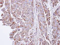 Immunohistochemistry (Formalin/PFA-fixed paraffin-embedded sections) - Anti-SGSH/HSS antibody (AB96029)