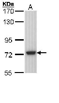 Western blot - Anti-SGSH/HSS antibody (AB96029), expandable thumbnail