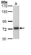 Western blot - Anti-SGSH/HSS antibody (AB96029)