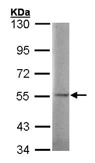 Western blot - Anti-SGSH/HSS antibody (AB96030)