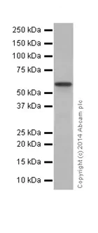 Western blot - Anti-SGSH/HSS antibody [EPR17312] (AB200346)