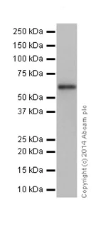 Western blot - Anti-SGSH/HSS antibody [EPR17312] (AB200346)