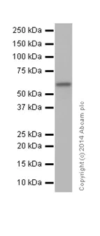 Western blot - Anti-SGSH/HSS antibody [EPR17312] (AB200346)