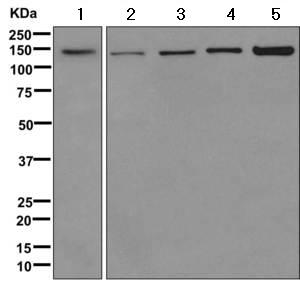 Western blot - Anti-SGSM1/RUTBC2 antibody [EPR11563] (AB171943)