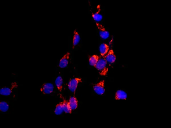 Immunocytochemistry/ Immunofluorescence - Anti-SGSM1/RUTBC2 antibody [EPR11563] - BSA and Azide free (AB249662)