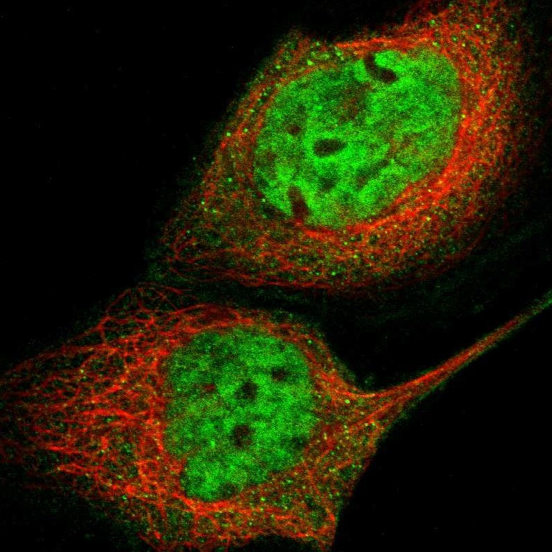 Immunocytochemistry/ Immunofluorescence - Anti-SGT1/ECD antibody (AB246881), expandable thumbnail