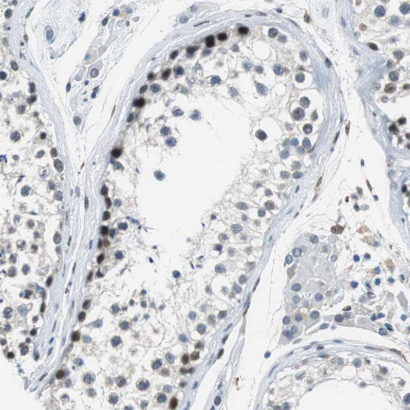 Immunohistochemistry (Formalin/PFA-fixed paraffin-embedded sections) - Anti-SGT1/ECD antibody (AB246881), expandable thumbnail
