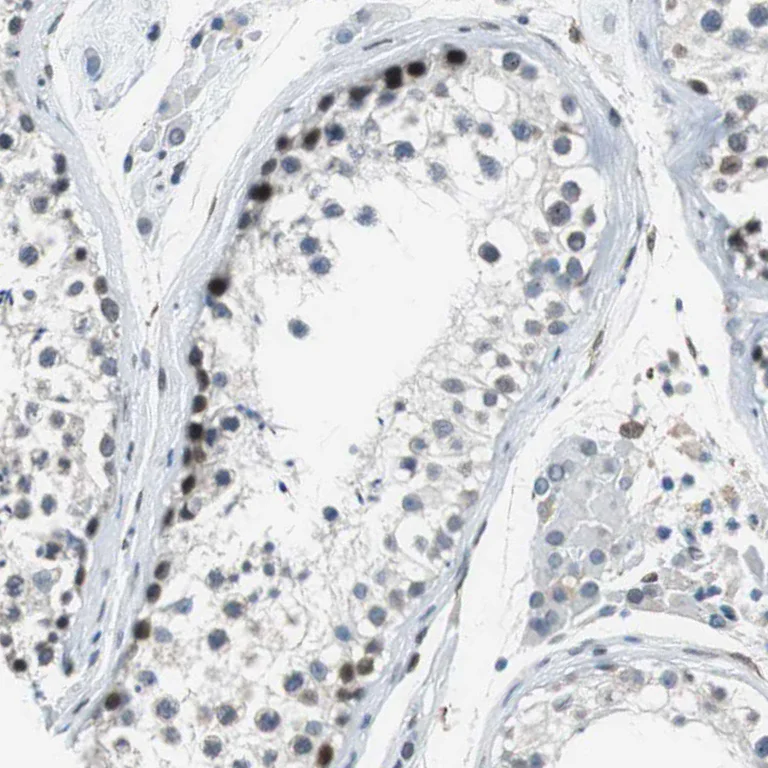 Immunohistochemistry (Formalin/PFA-fixed paraffin-embedded sections) - Anti-SGT1/ECD antibody (AB246881)