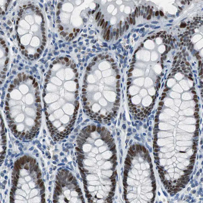 Immunohistochemistry (Formalin/PFA-fixed paraffin-embedded sections) - Anti-SGT1/ECD antibody (AB246881)