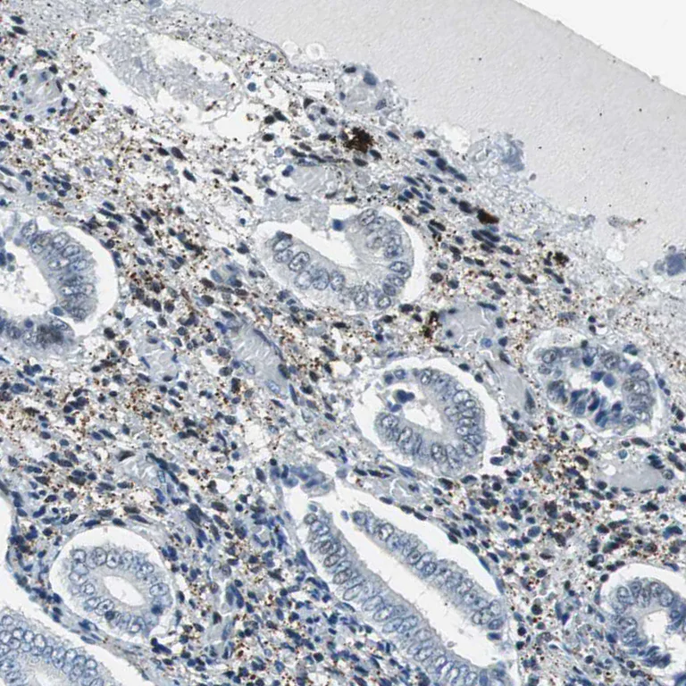 Immunohistochemistry (Formalin/PFA-fixed paraffin-embedded sections) - Anti-SGT1/ECD antibody (AB246881)